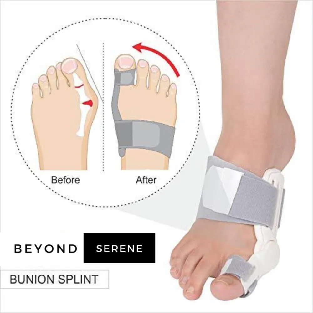 Nanccy - Orthopedic Bunion Splint