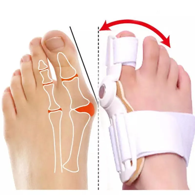 Nanccy - Orthopedic Bunion Splint