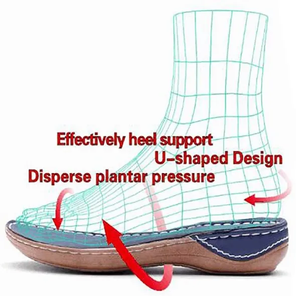 Wedges Orthopedic Hollow Out PU Summer Vintage Sandals